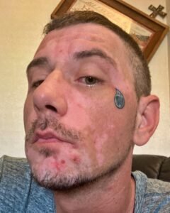 face of corey lee sargent with green miyagi brand logo tattoo on left cheek of face