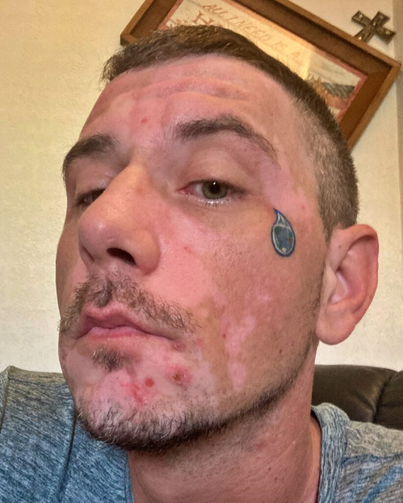 face of corey lee sargent with green miyagi brand logo tattoo on left cheek of face